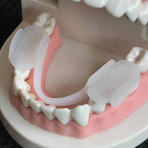 ASOMI סיליקון לילה אנטי ללבוש השיניים סד פיו ישנה שן שן שומר משטח הגנה